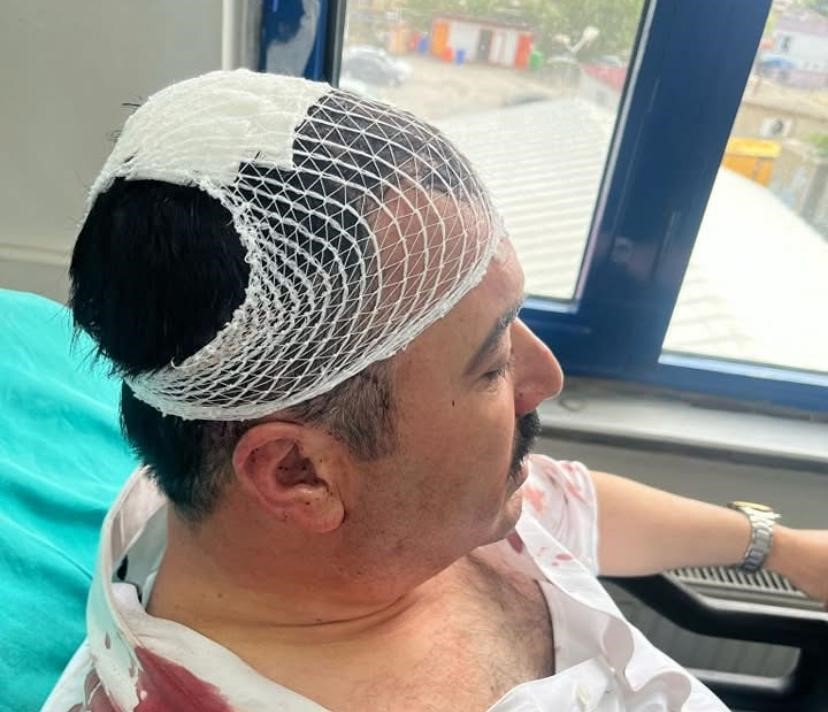 belediye-baskan-yardimcisini-sekerlikle-yaralayan-yrpli-baskan-yardimcisi-tutuklandi-0-jpg