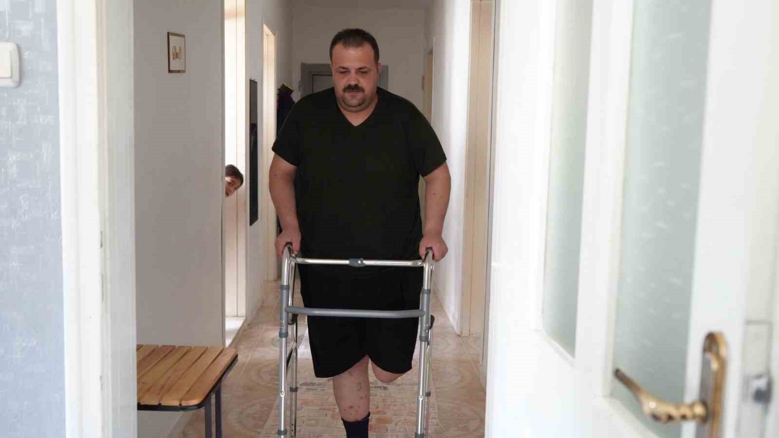 terapi-sonrasi-felaket-tedavi-icin-gitti-ayagi-kesildi