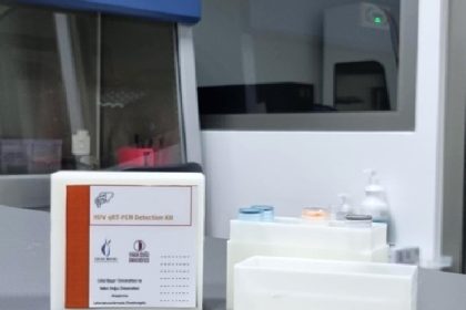hepatit-dye-karsi-yerli-tani-kiti-gelistirildi