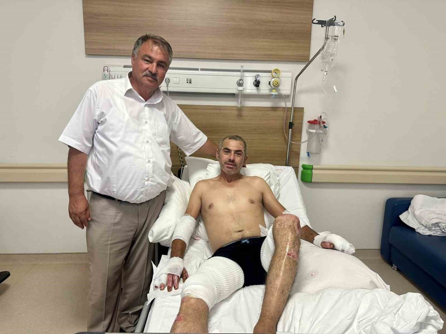 baskan-putun-eskisehir-yangininda-yaralanan-orman-iscisini-yalniz-birakmiyor