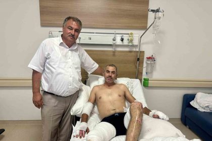 baskan-putun-eskisehir-yangininda-yaralanan-orman-iscisini-yalniz-birakmiyor