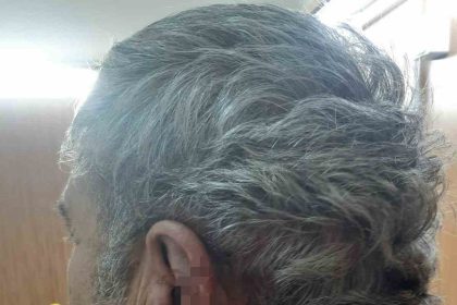 doktor-ile-emekli-ogretmenin-mesai-kavgasi-karakolda-bitti