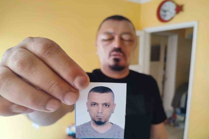 saclarini-siyahlatmak-icin-aldigi-sampuan-ari-sokmasindan-beter-hale-getirdi
