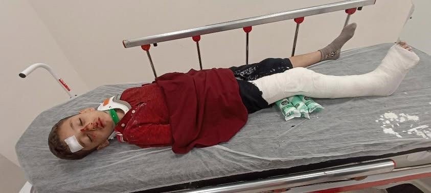 basaksehirde-8-yasindaki-cocuga-trafige-kapali-alanda-motosiklet-carpti-baba-yardim-istedi