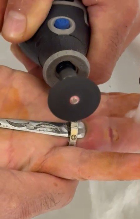 parmagina-yuzuk-sikisan-kadinin-yardimina-itfaiye-yetisti