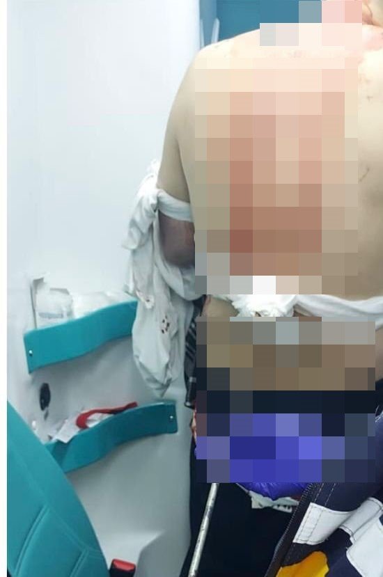 abisini-sokak-ortasinda-silahla-vurarak-oldurdu