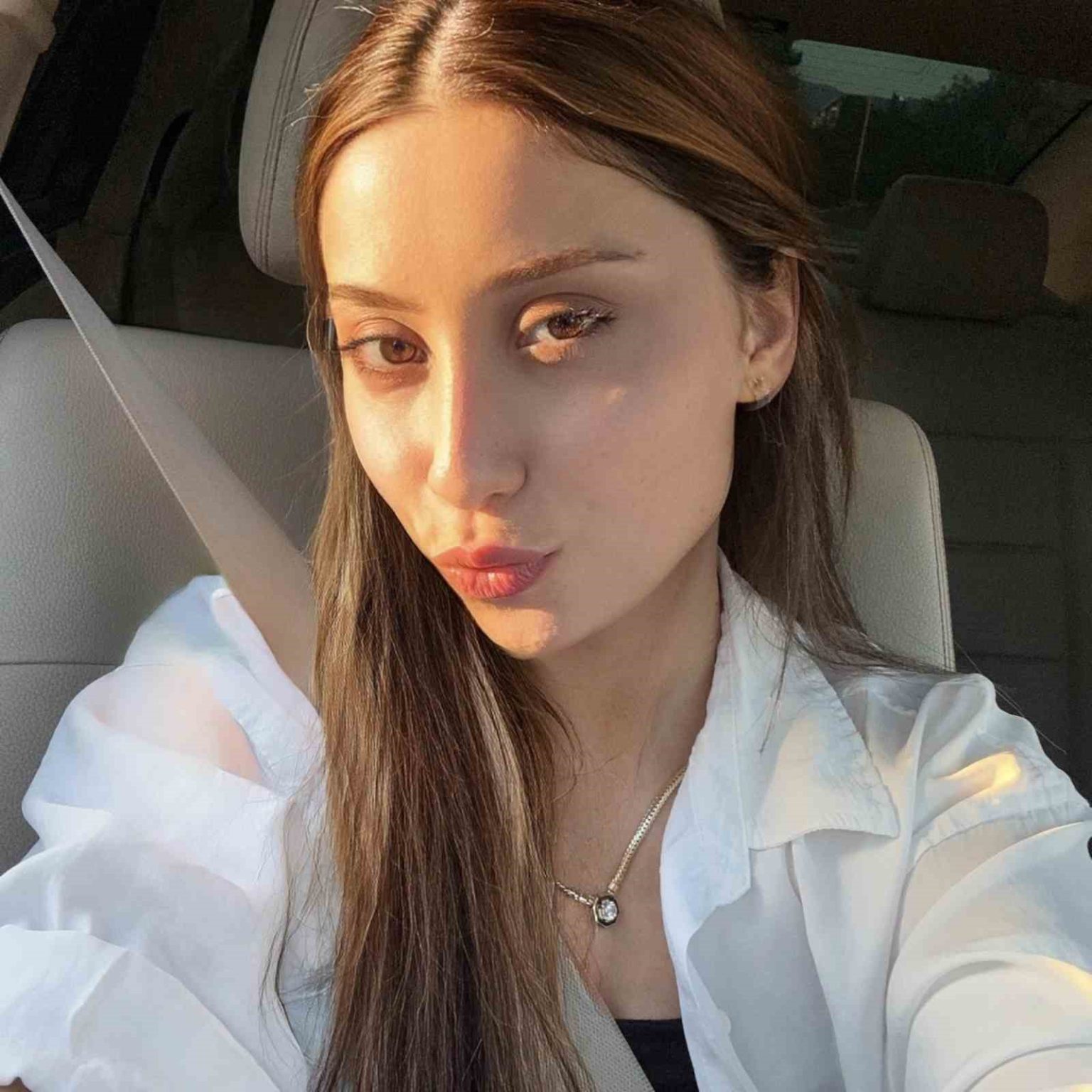 yemek-yerken-bacagina-yorgun-mermi-isabet-etti