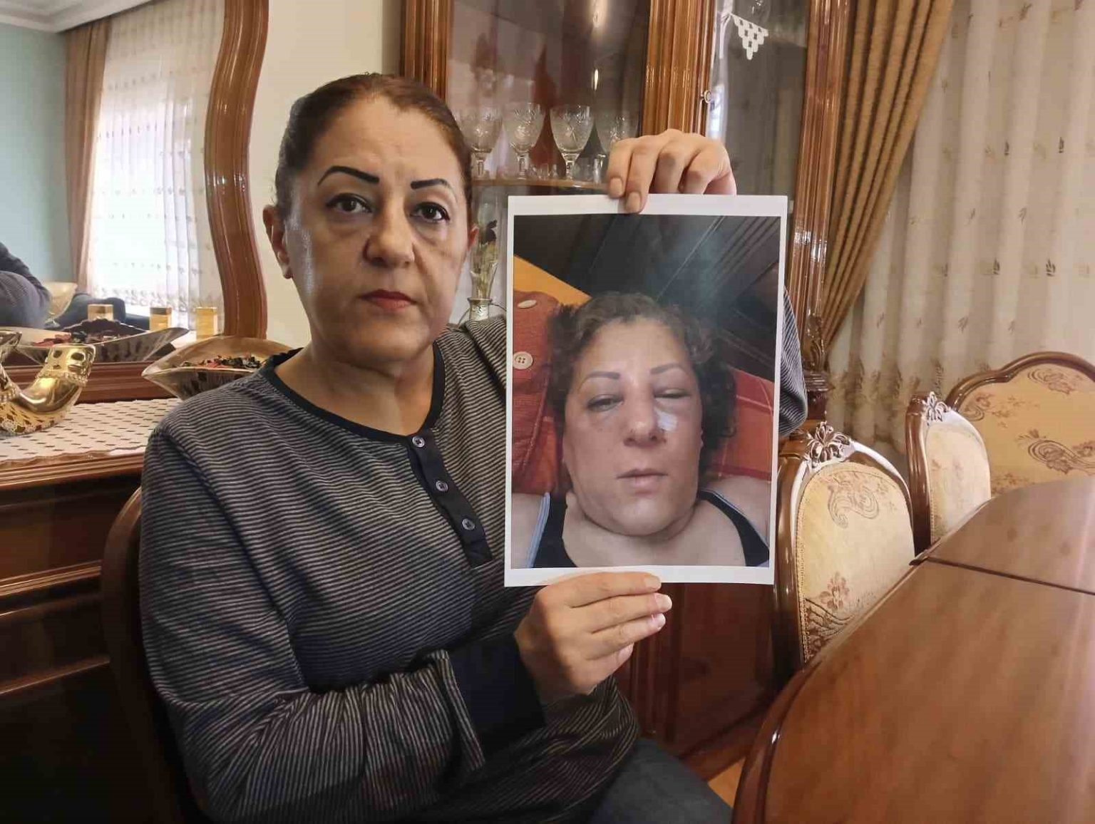 apartman-bahcesinde-besledigi-kediler-nedeniyle-komsulari-tarafindan-darbedilen-kadinin-burnu-kirildi