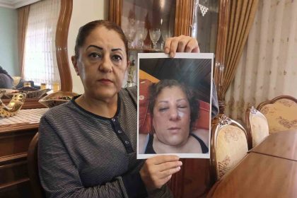 apartman-bahcesinde-besledigi-kediler-nedeniyle-komsulari-tarafindan-darbedilen-kadinin-burnu-kirildi