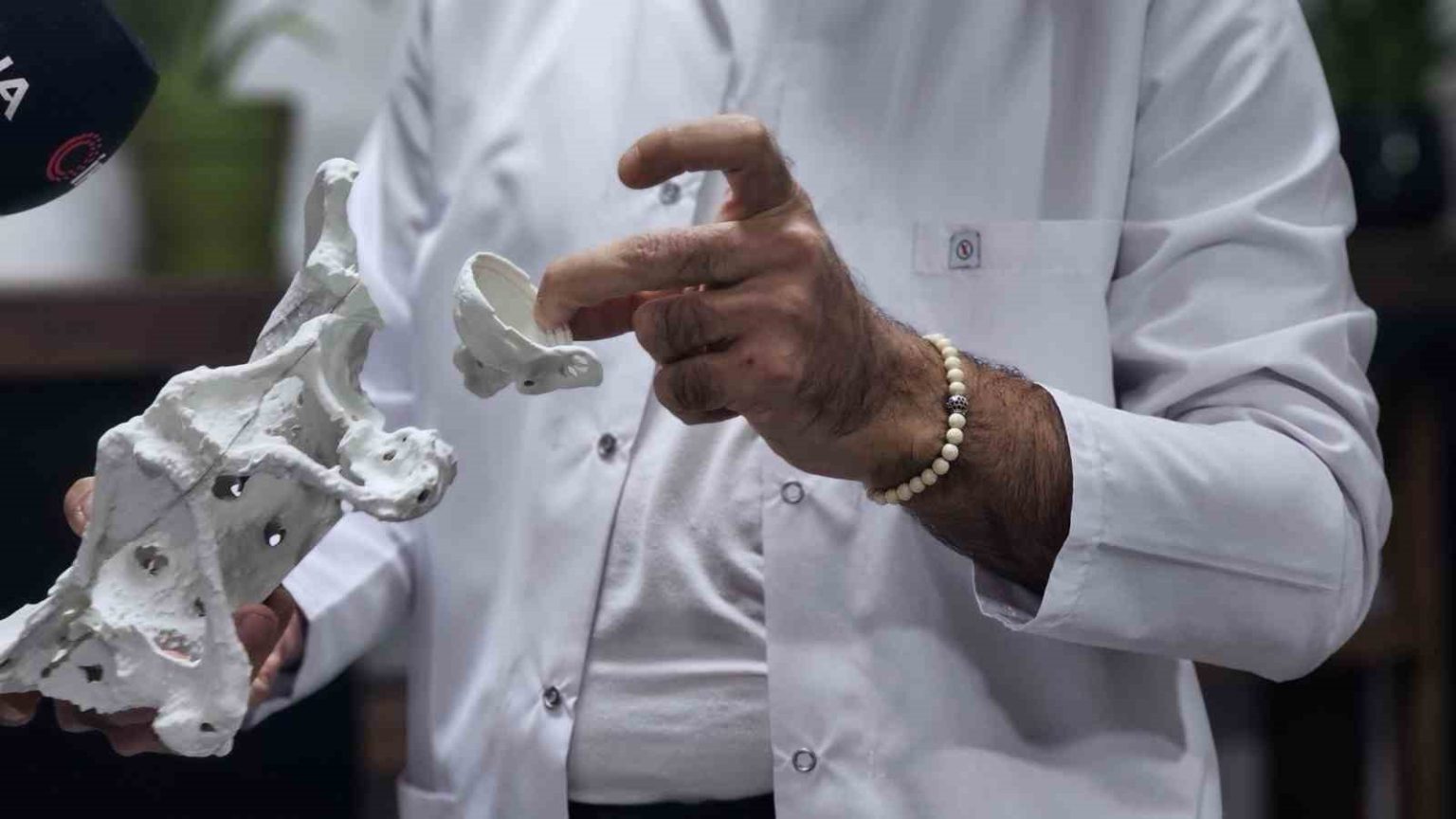 60-yasindaki-kadin-3d-yaziciyla-uretilen-kalca-proteziyle-sagligina-kavustu