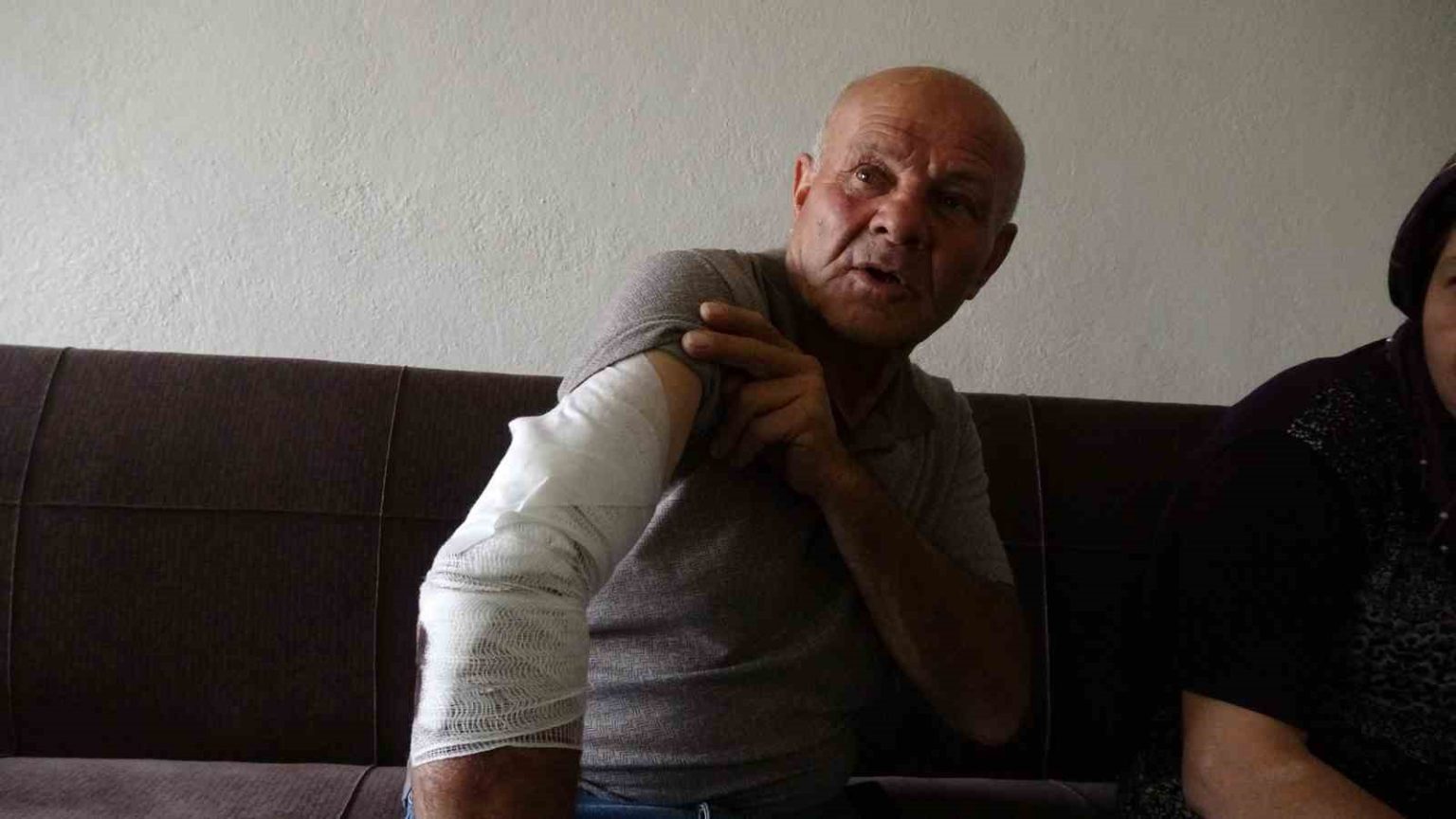 beslemek-istedigi-kopek-saldirdi-koluna-10dan-fazla-dikis-atildi