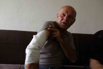 beslemek-istedigi-kopek-saldirdi-koluna-10dan-fazla-dikis-atildi