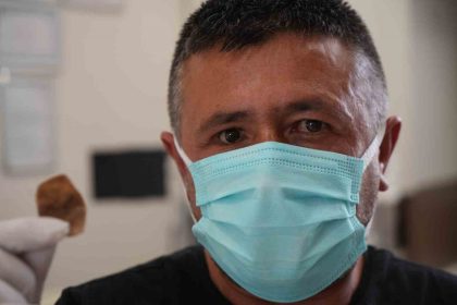 protez-gozu-hayatini-kabusa-cevirdi