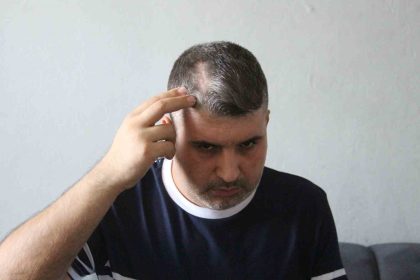 beyzbol-sopali-saldirgan-dayi-serbest-kalinca-yegeni-yardim-istedi-can-guvenligim-yok