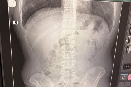 usakta-midelerinden-uyusturucu-cikti-iranli-3-kisi-tutuklandi