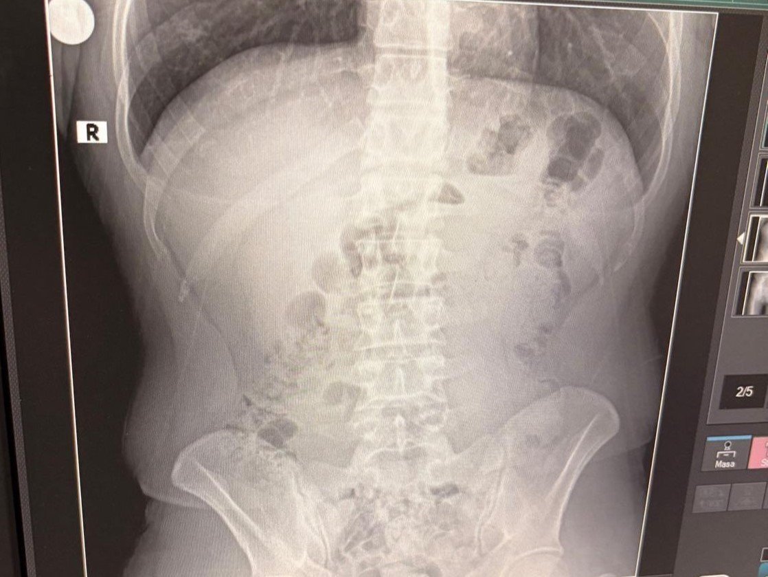 usakta-midelerinden-uyusturucu-cikti-iranli-3-kisi-tutuklandi