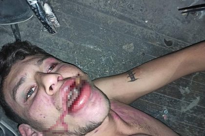 antalyada-bocek-yedirip-dislerimi-kirdilar-iddiasina-20-yil-hapis-talebi