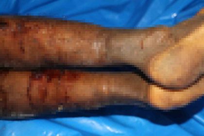 israilin-iade-ettigi-cenazelerde-iskence-izleri-goruldu