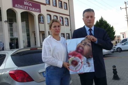 ilkokul-ogrencisinin-cenesi-saplanan-demir-yuzunden-koptu-ailesi-okula-ihmal-davasi-acti