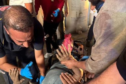 batmanda-geri-donusum-tesisinde-is-kazasi-bir-kisi-helezona-sikisti