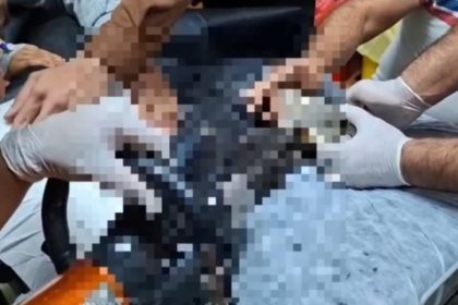 tel-abyadta-elini-kiyma-makinesine-kaptiran-cocuk-sanliurfada-tedavi-altina-alindi