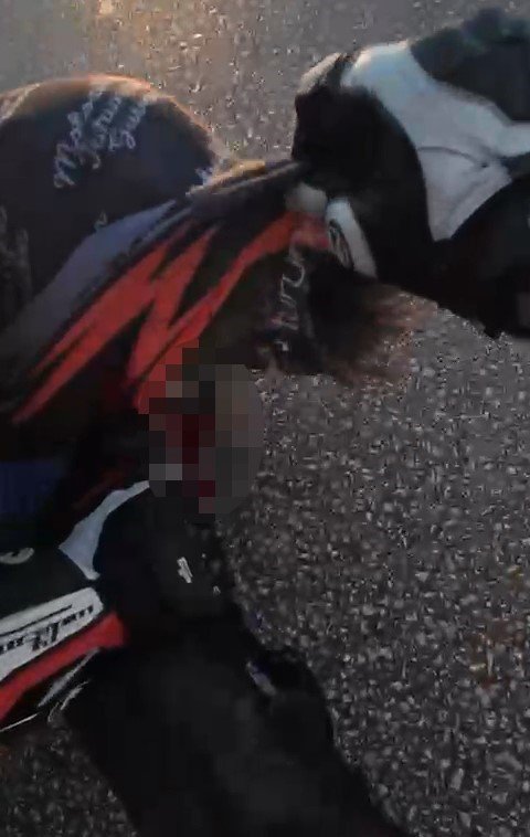 motosikletiyle-bariyere-carpmisti-hayata-25-gun-tutunabildi