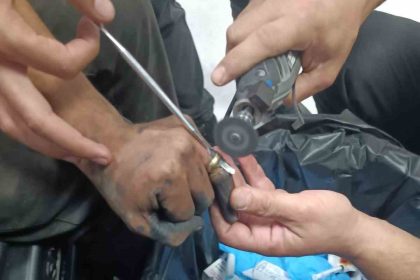 parmakta-sikisan-yuzuk-hastanede-doktor-ve-itfaiye-ekibi-tarafindan-cikartildi