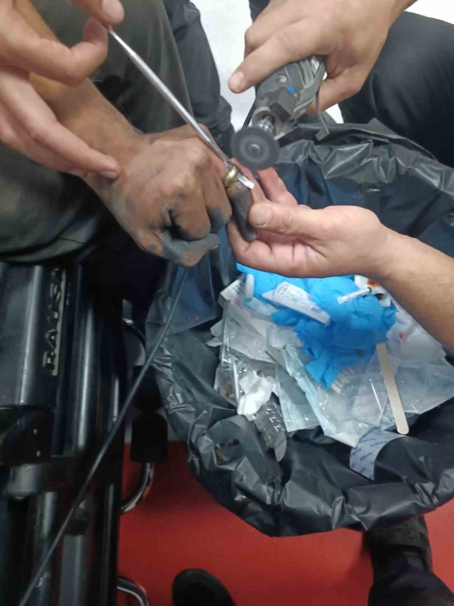 parmakta-sikisan-yuzuk-hastanede-doktor-ve-itfaiye-ekibi-tarafindan-cikartildi