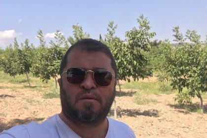 cocuklarini-gormek-icin-gitti-satirli-saldiriya-ugradi