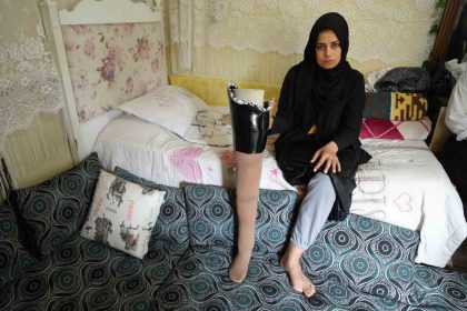 kahramanmaras-merkezli-buyuk-depremde-bacagini-kaybetti-esi-terk-etti