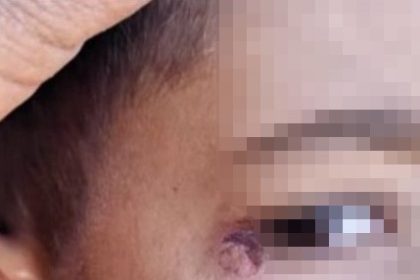 ogrencinin-yuzunde-sigara-sonduren-temizlik-gorevlisi-tutuklandi