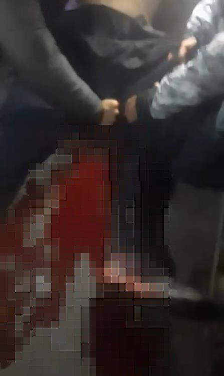 uskudarda-bicakli-kavga-1-yarali