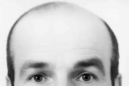 hayvan-otlatirken-elektrik-akimina-kapilan-sahis-hayatini-kaybetti