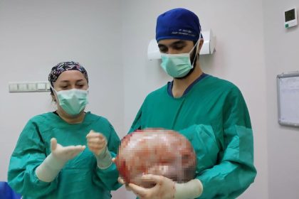 karni-2-ayda-9-aylik-hamile-gibi-buyuyen-kadinin-icinden-karpuz-kadar-kitle-cikarildi