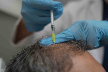 dokulen-saclar-vucudun-bir-alarmi-olabilir