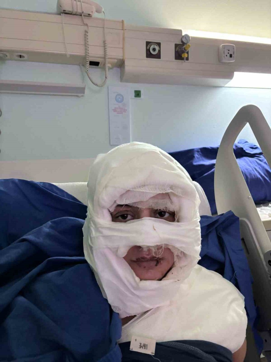 kadikoyde-akil-almaz-olay-genc-kadin-baska-bir-kadin-tarafindan-atese-verildi