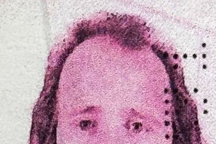 ingiliz-vatandasi-turkiyede-sac-ekimi-ve-dis-tedavisi-ardindan-hayatini-kaybetti