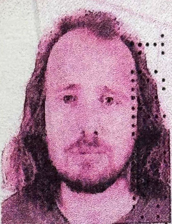 ingiliz-vatandasi-turkiyede-sac-ekimi-ve-dis-tedavisi-ardindan-hayatini-kaybetti